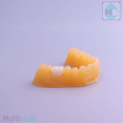 Печать 3D-смолой Dental Crown LCD