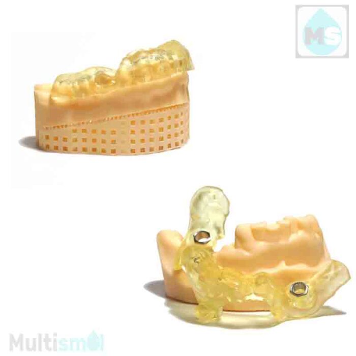 Хирургические шаблоны из HARZ Labs Dental Yellow Clear PRO